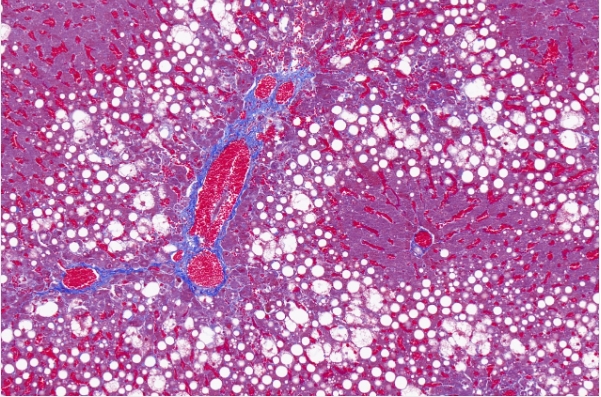 masson染色 (胶原纤维)主图